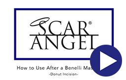 How To Use Scar Angel On A Donut Incision Video