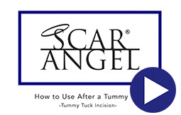 How To Use Scar Angel After A Tummy Tuck Video